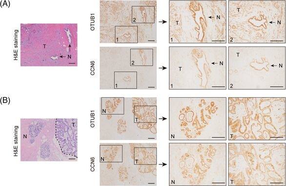Otubain-1 Antibody