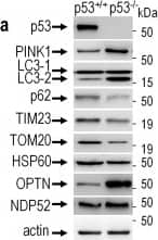 p62/SQSTM1 Antibody