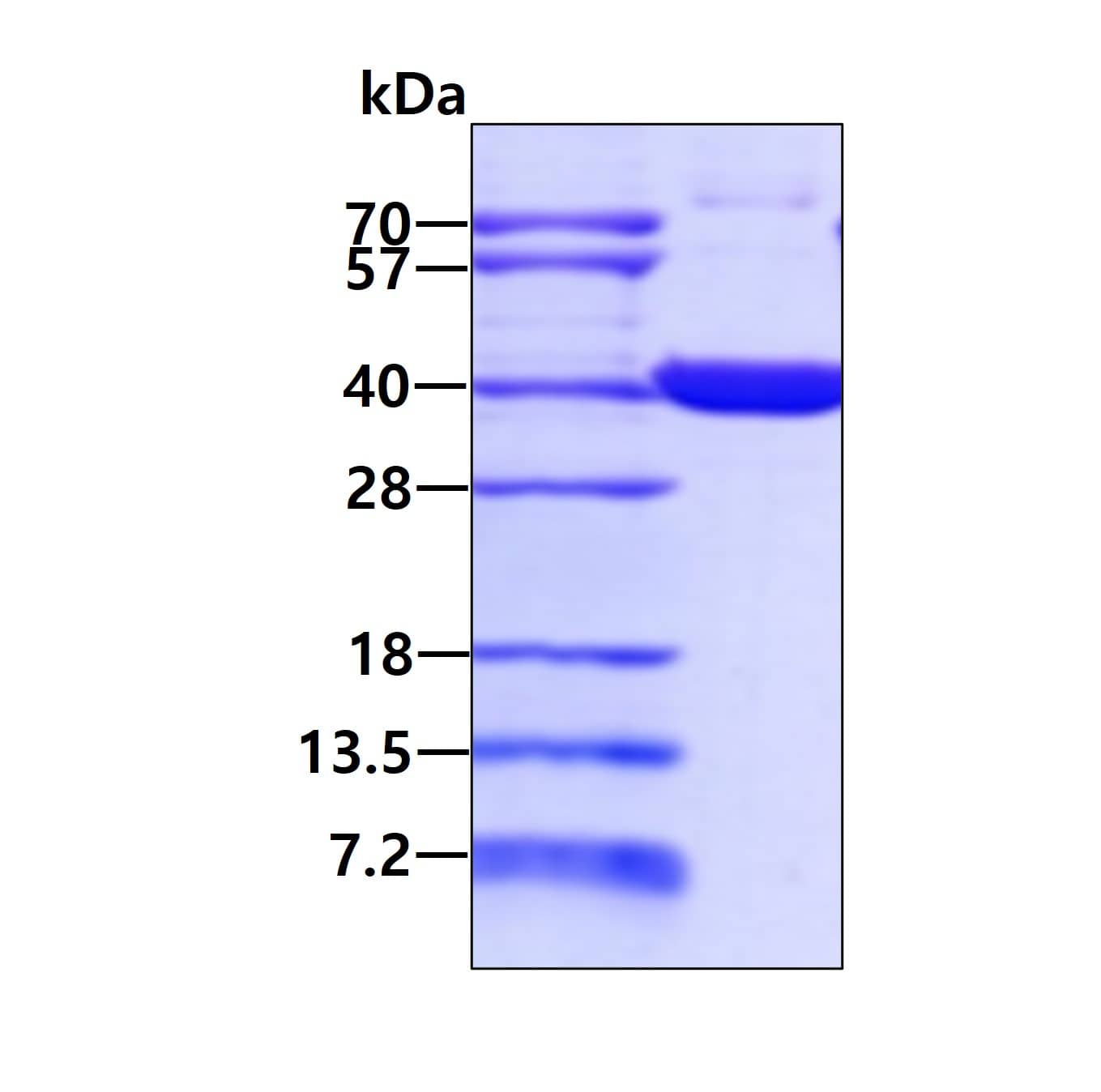 Recombinant Human WDR5 His Protein