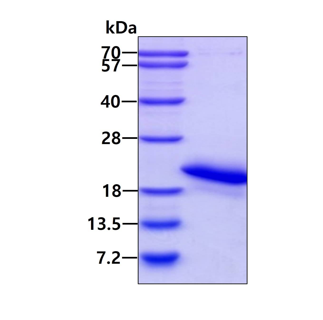 Recombinant Human Myoglobin His Protein