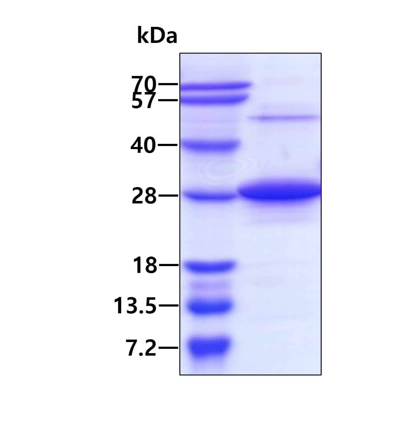 Recombinant Human Rab7a His Protein