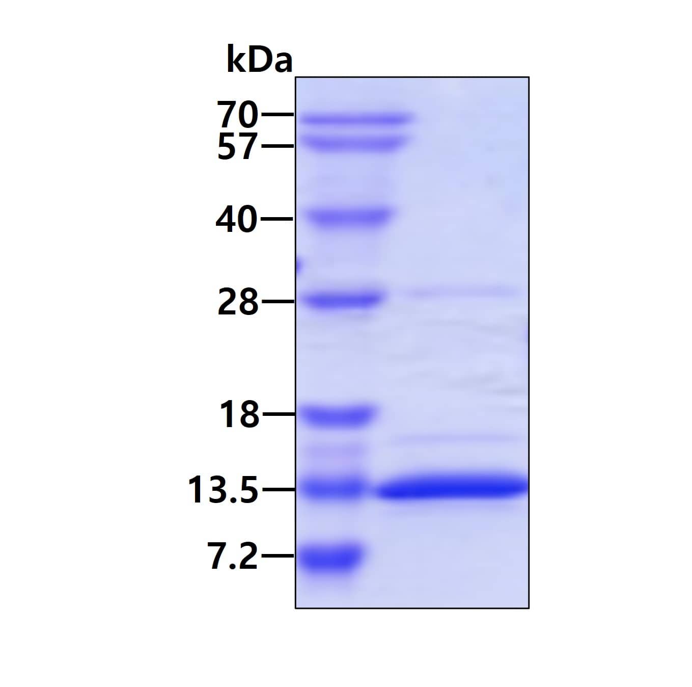 Recombinant Human S100A10 His Protein