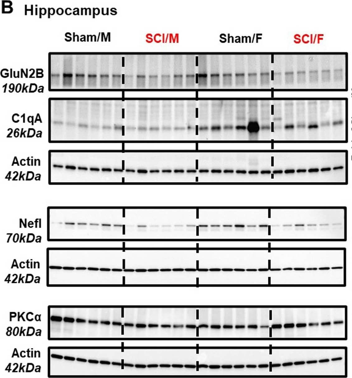 Complement Component C1qA Antibody (JL-1) - Azide Free