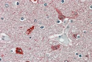 CaM Kinase II alpha Antibody