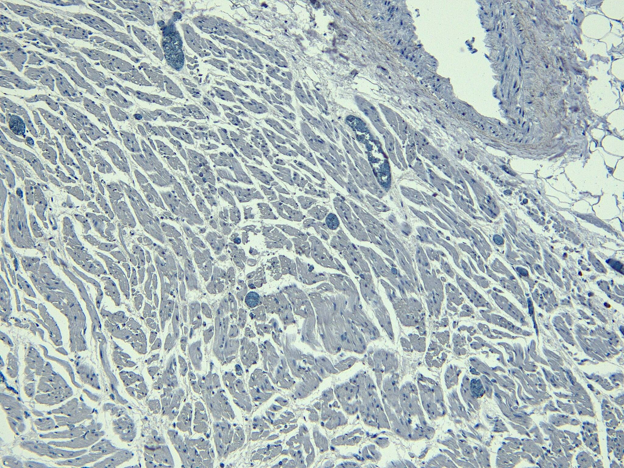 NKX2.5 Antibody