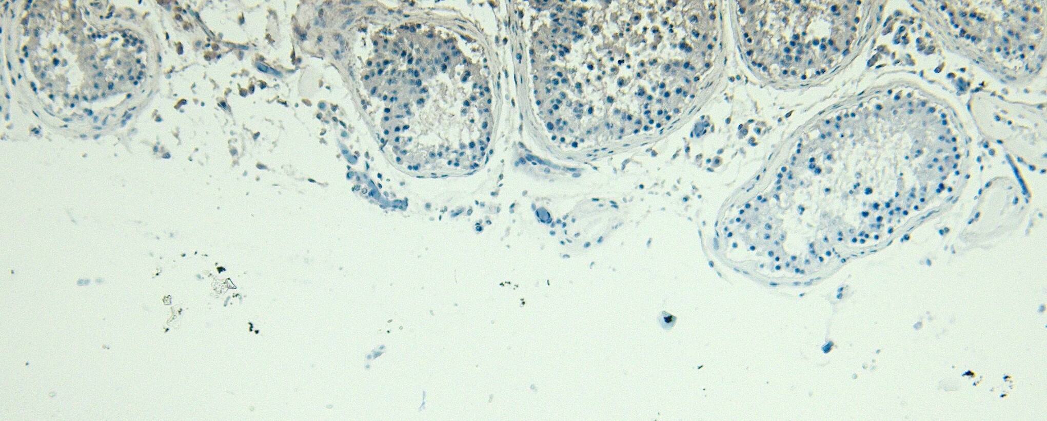 BLIMP1/PRDM1 Antibody