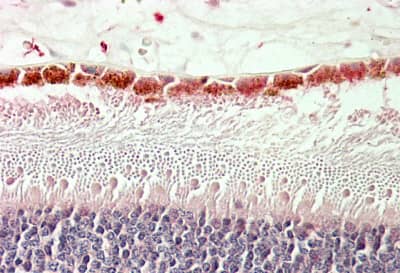 RDH5 Antibody