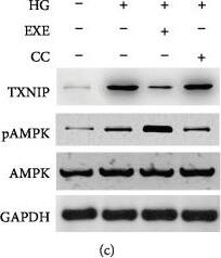 TXNIP Antibody (JY2) - Azide and BSA Free