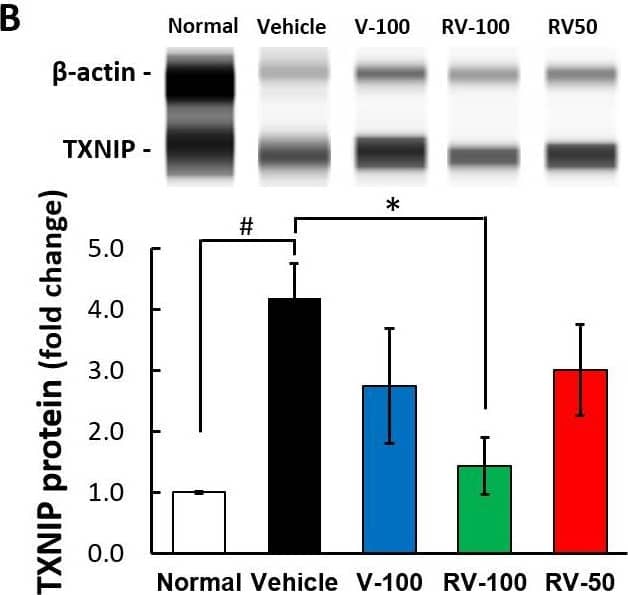 TXNIP Antibody (JY2) - Azide and BSA Free