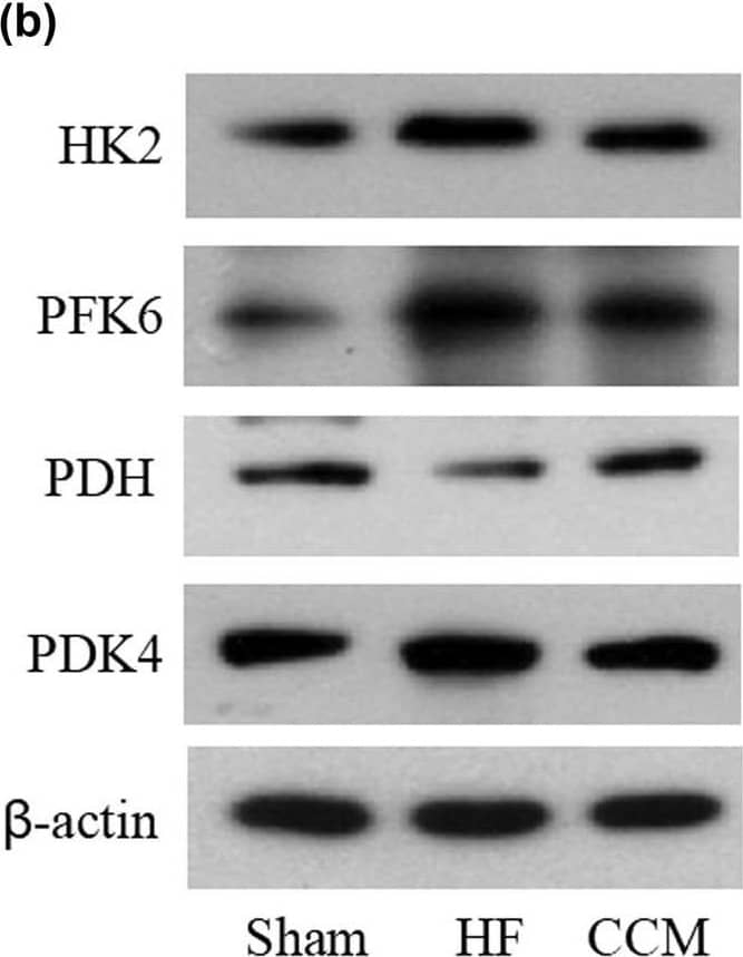 PDK4 Antibody - BSA Free
