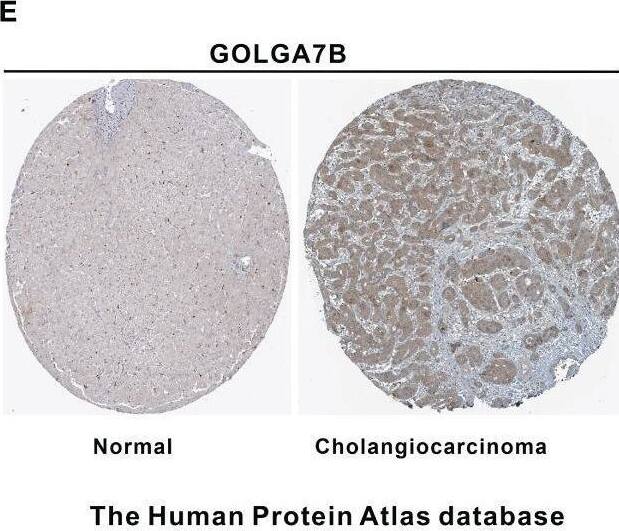 GOLGA7B Antibody - BSA Free