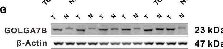GOLGA7B Antibody - BSA Free