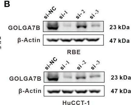 GOLGA7B Antibody - BSA Free