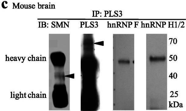 hnRNP F Antibody