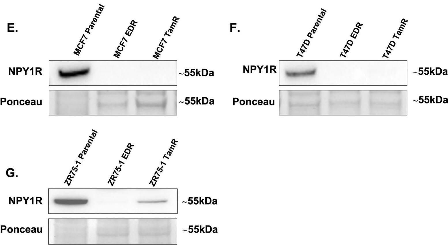 NPY1R Antibody
