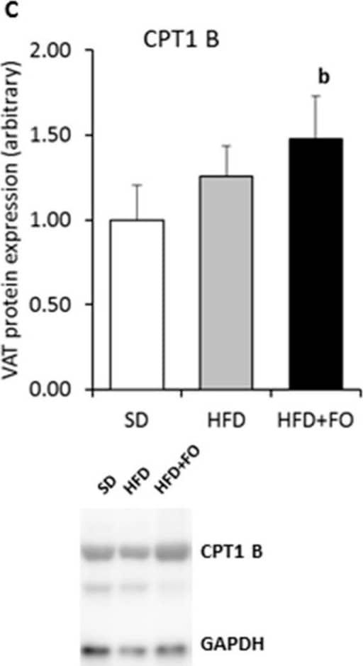 CPT1B Antibody - BSA Free