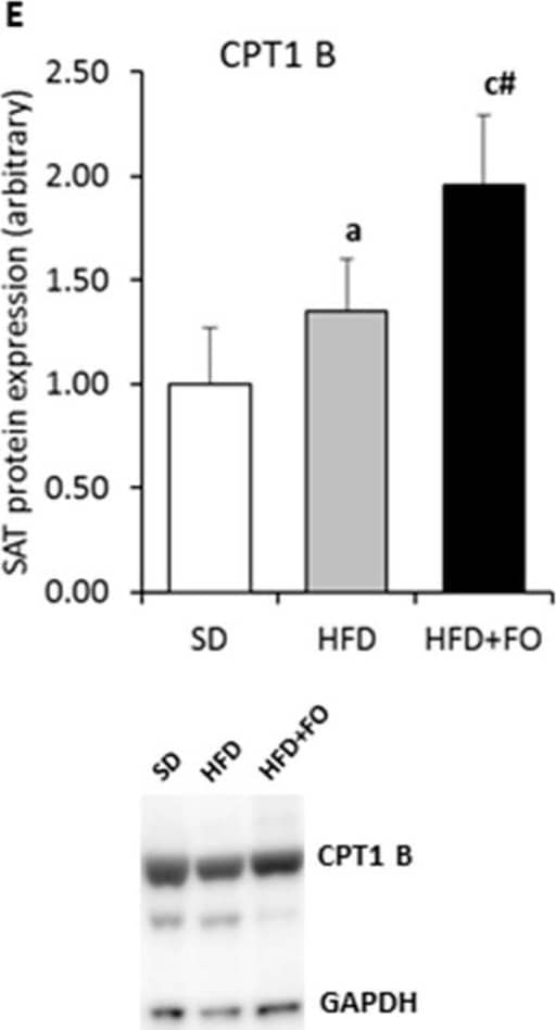 CPT1B Antibody - BSA Free
