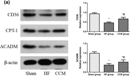 CPT1B Antibody - BSA Free