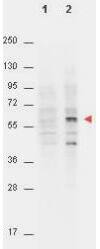 AKT1 [p Thr308] Antibody (18F3.H11)