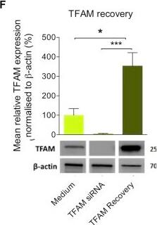 mtTFA Antibody (18G102B2E11)