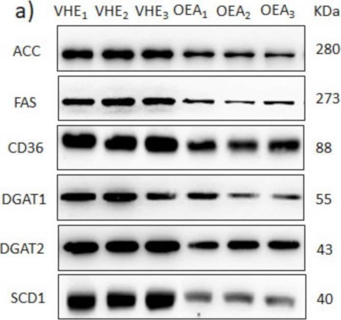 DGAT2 Antibody - BSA Free
