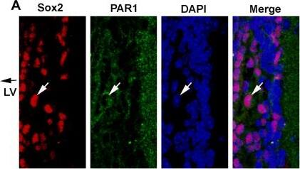 PAR1/Thrombin Receptor Antibody (N2-11)