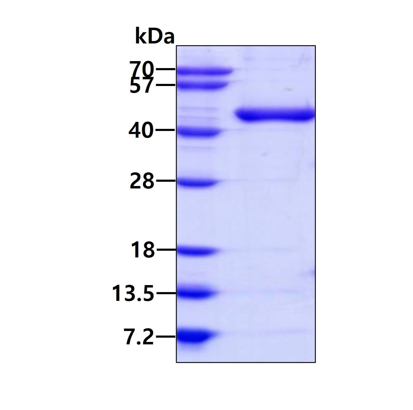 Recombinant Human Septin-5 His Protein