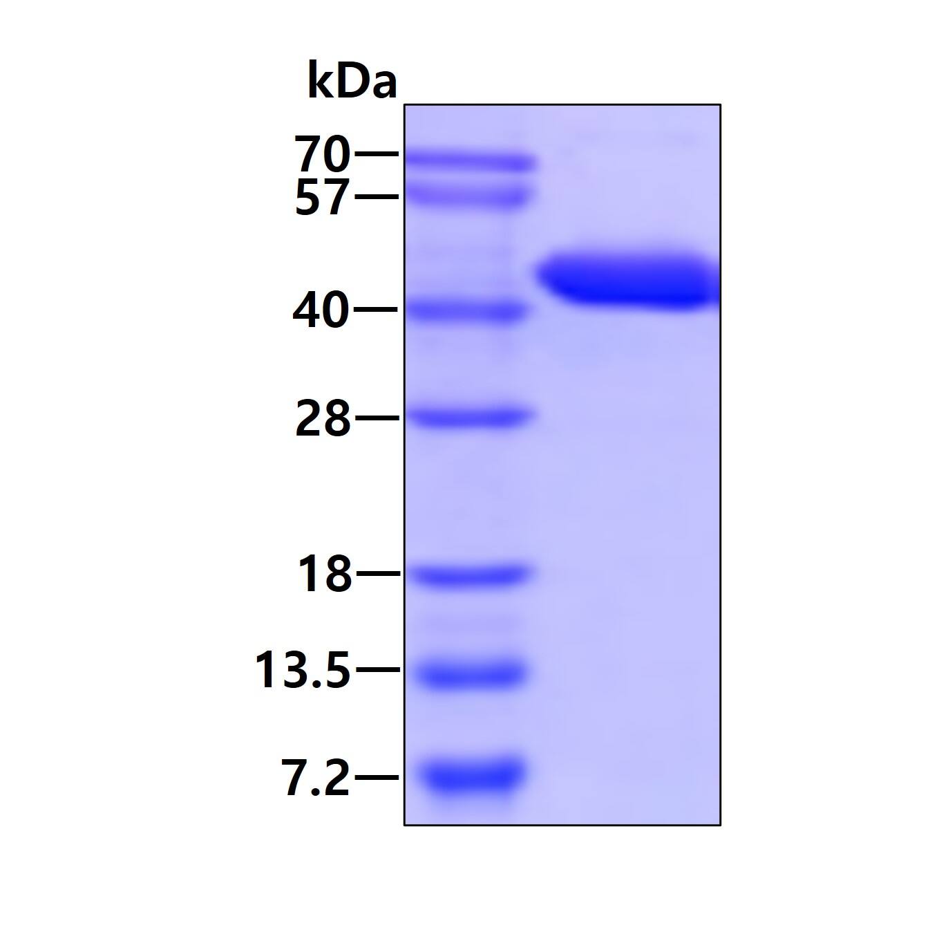 Recombinant Human G protein alpha inhibitor 1 His Protein