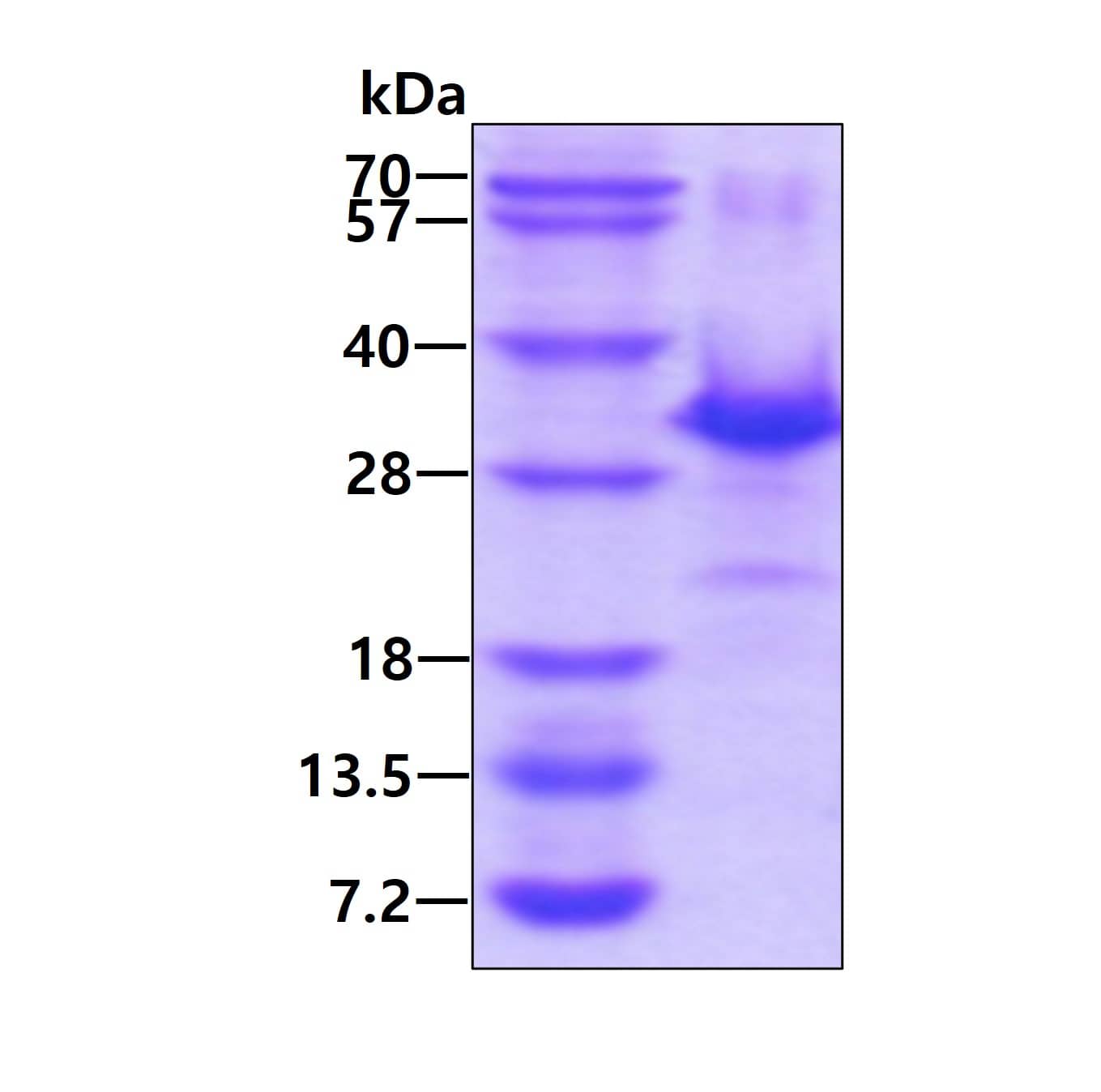 Recombinant Human p27/Kip1 His Protein