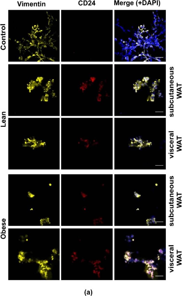 Donkey anti-Mouse IgG (H+L) Secondary Antibody [DyLight 594] (Pre-adsorbed)