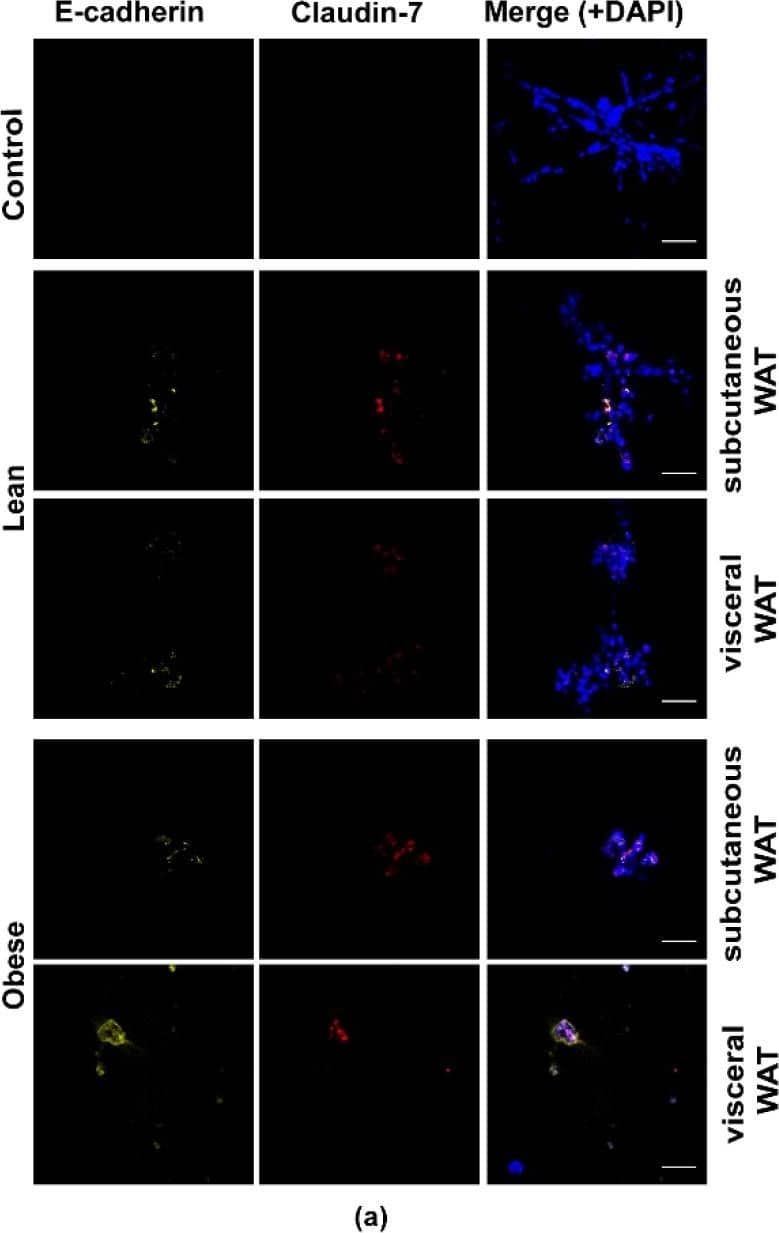 Donkey anti-Mouse IgG (H+L) Secondary Antibody [DyLight 594] (Pre-adsorbed)