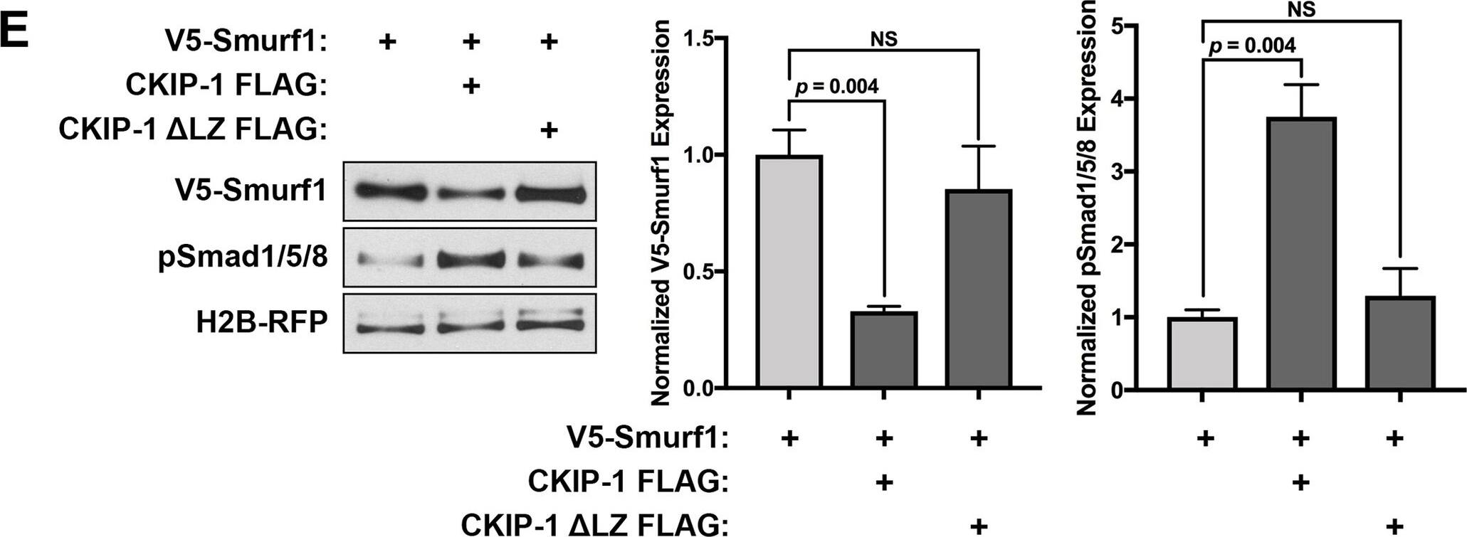CKIP-1 Antibody - BSA Free
