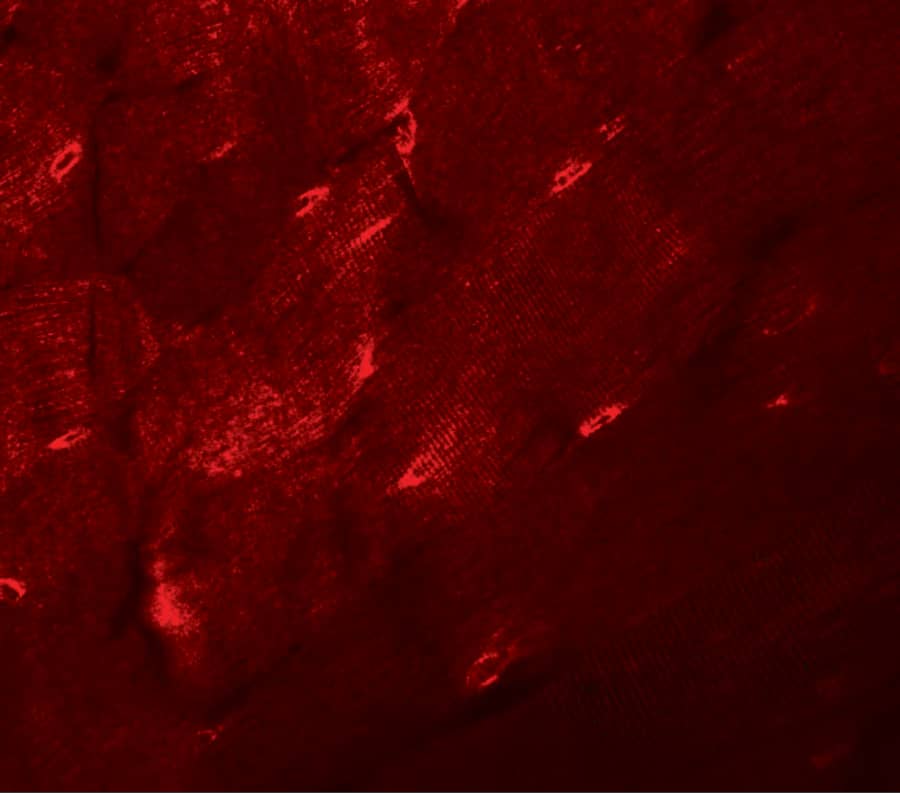 TMEM38A Antibody - BSA Free