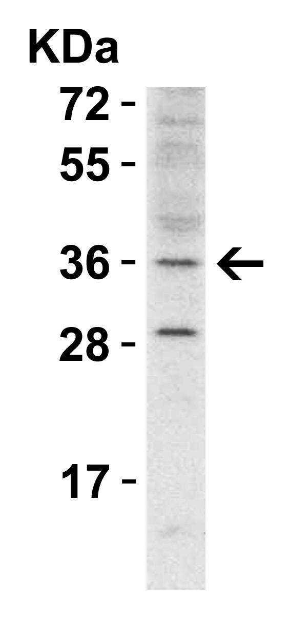 RHBDD1 Antibody - BSA Free