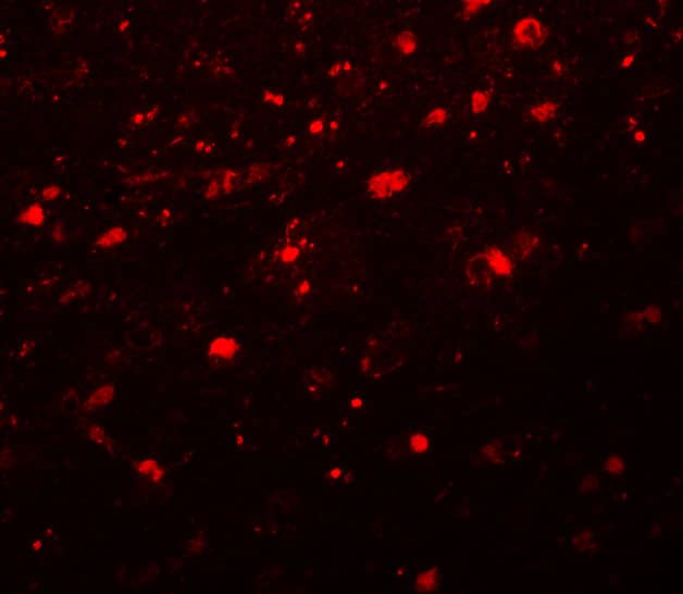 Girdin Antibody - BSA Free