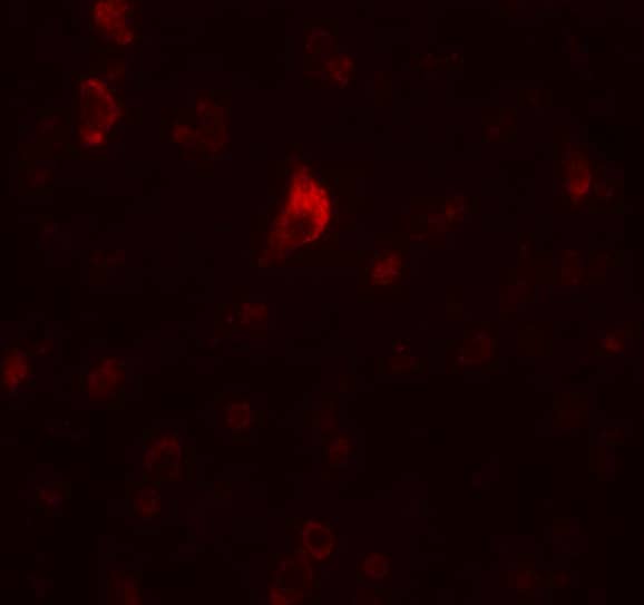PICALM Antibody - BSA Free