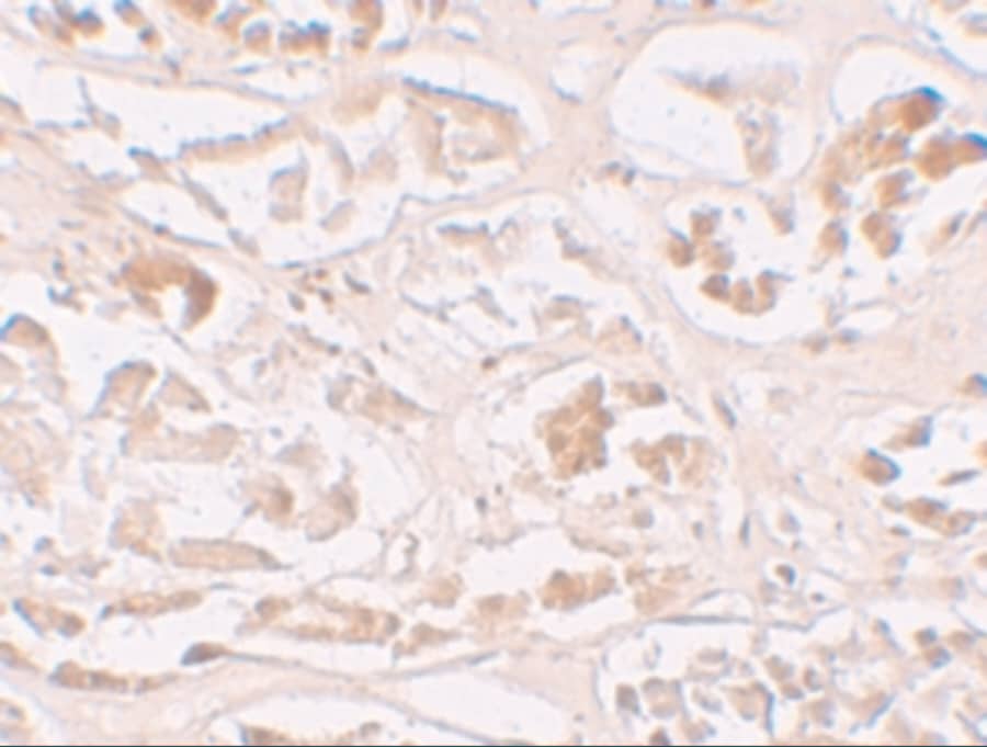 ABH2 Antibody - BSA Free