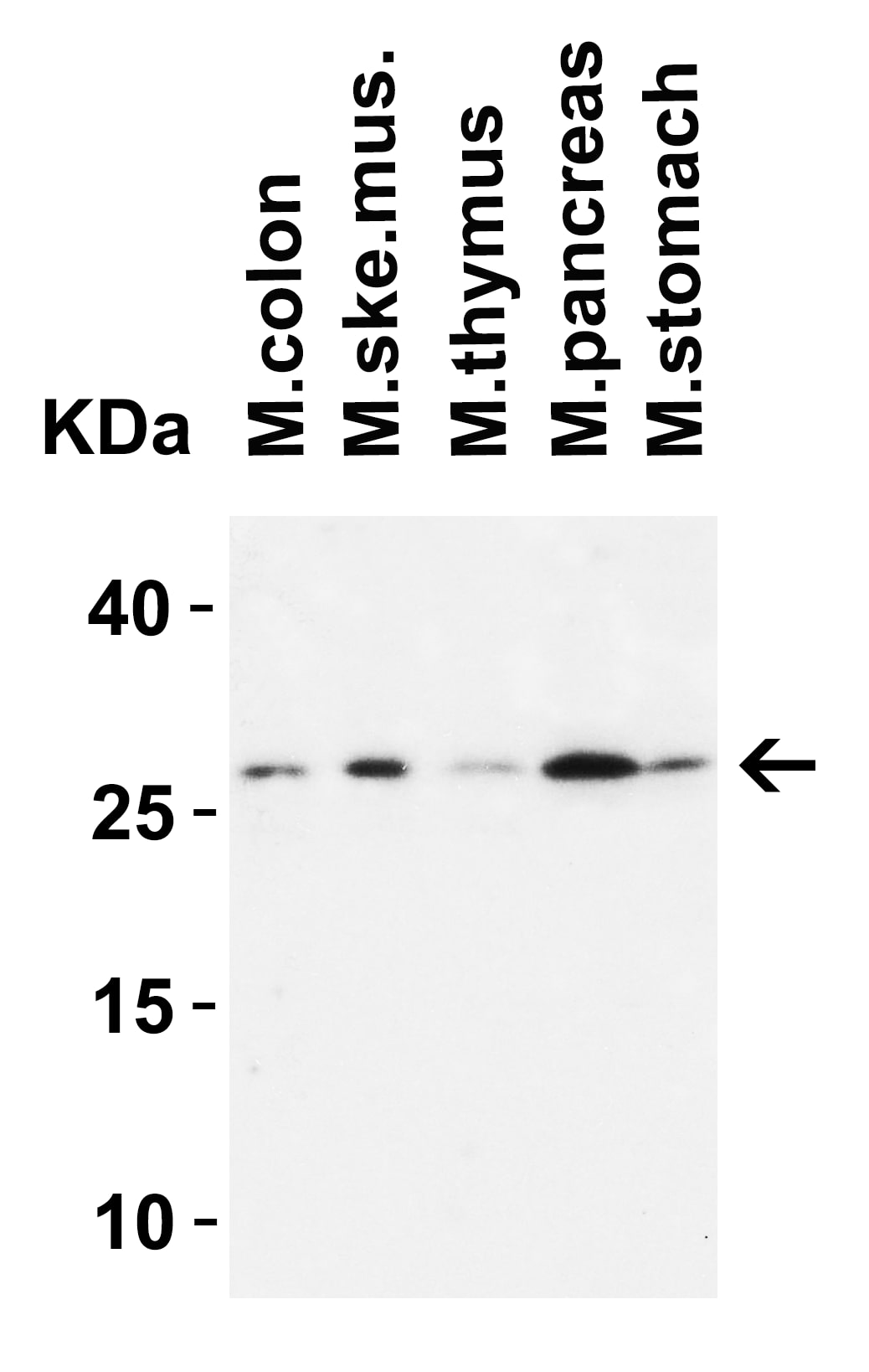 MOX1 Antibody - BSA Free