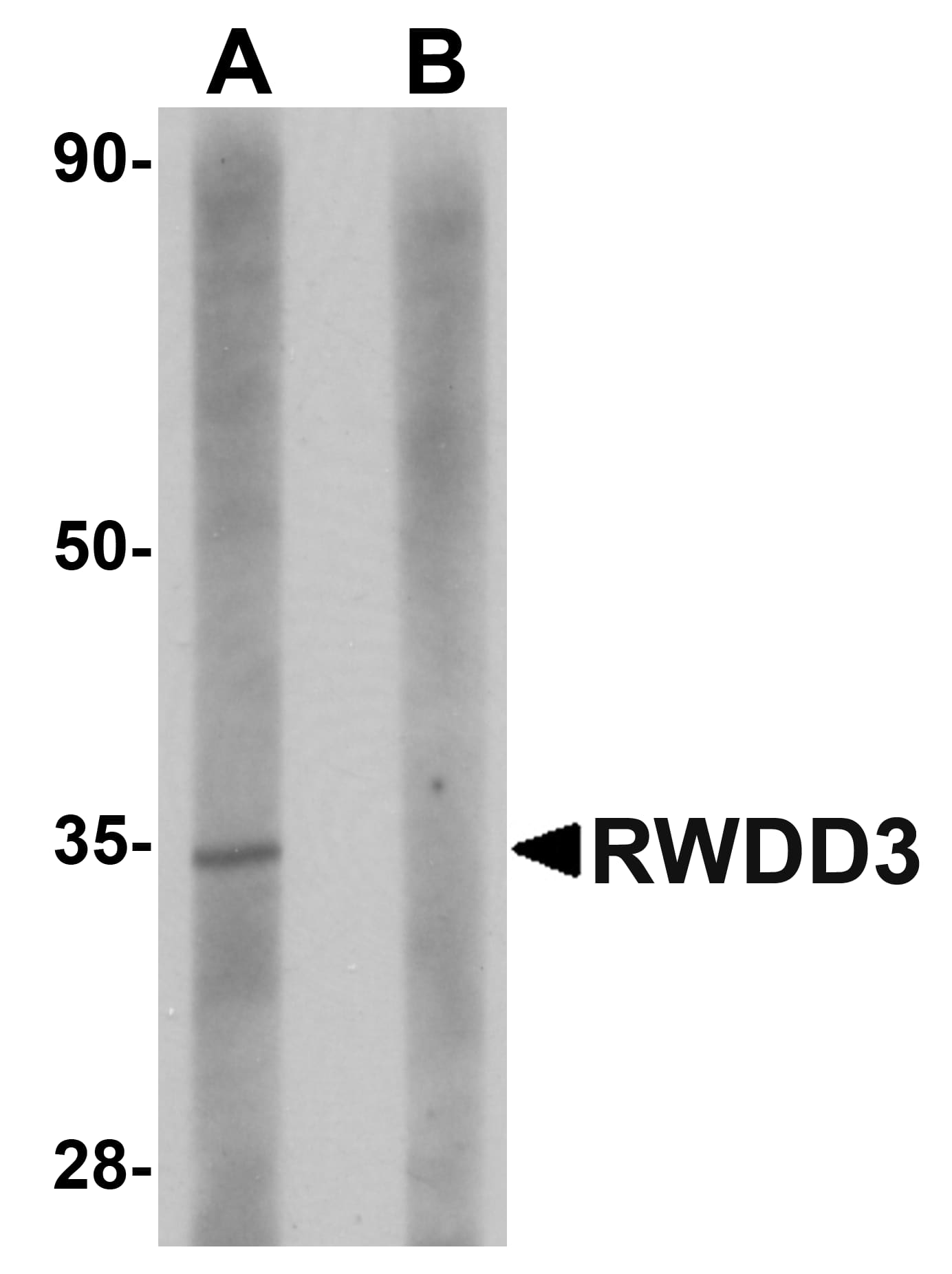 RWDD3 Antibody Blocking Peptide