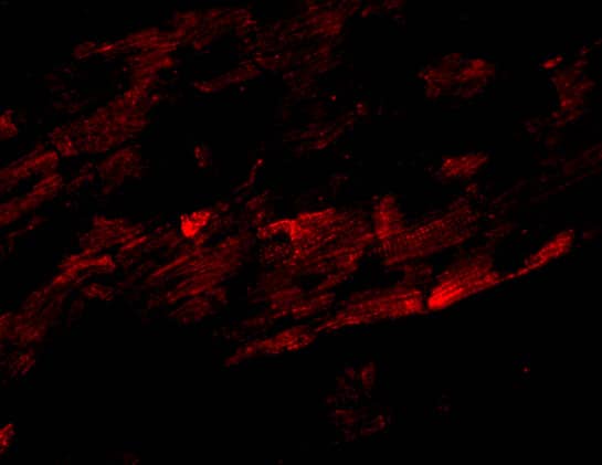 ZFYVE26 Antibody - BSA Free