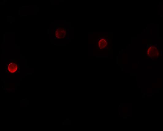 PLAC1 Antibody - BSA Free