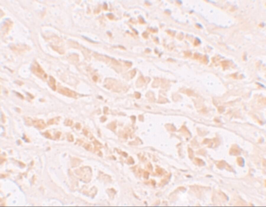 EFCAB4B Antibody - BSA Free