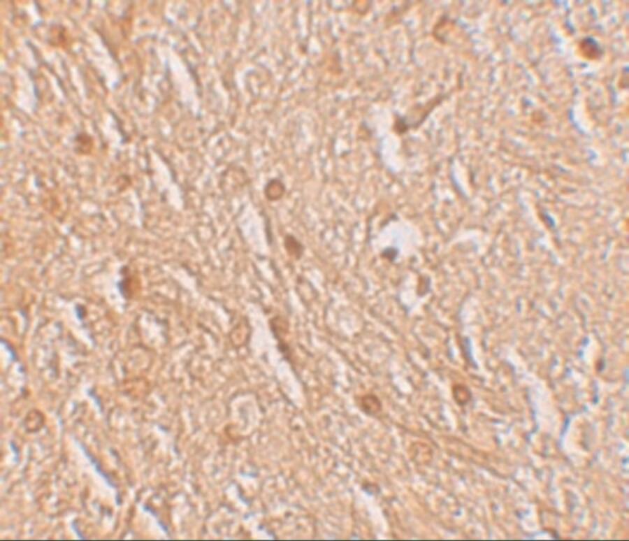 LMBRD1 Antibody - BSA Free