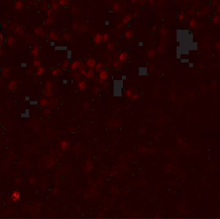 LMBRD1 Antibody - BSA Free