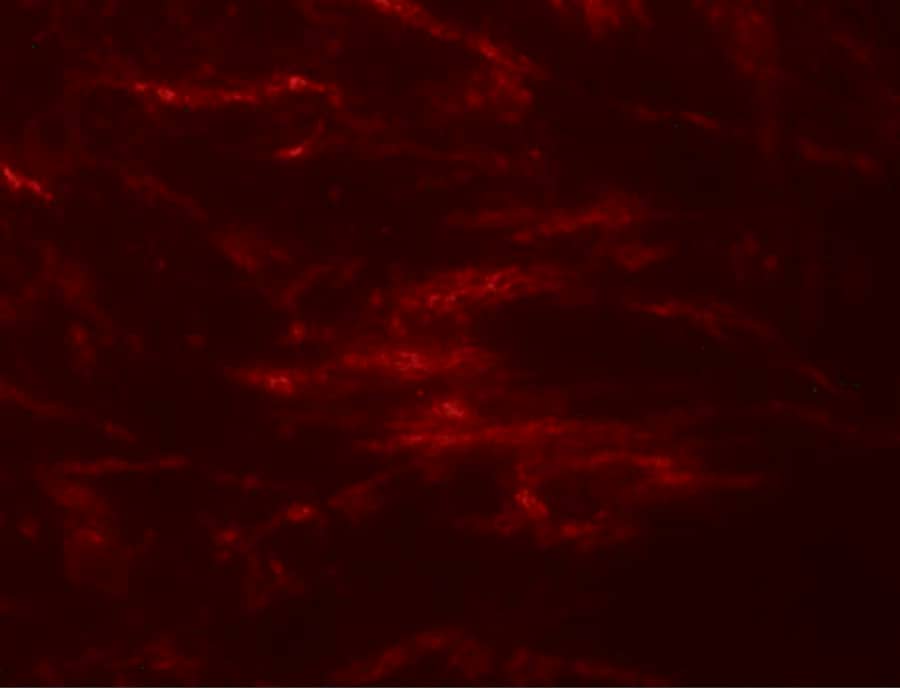 SLC39A2/ZIP2 Antibody - BSA Free