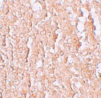 SLC39A10 Antibody - BSA Free
