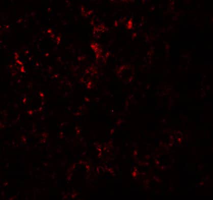 SLC39A14 Antibody - BSA Free