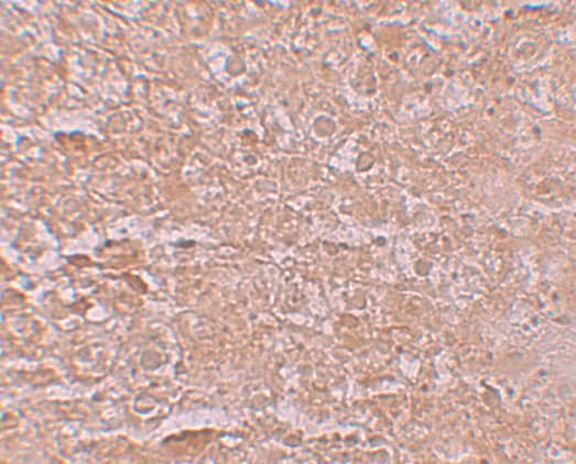 SLC39A14 Antibody - BSA Free