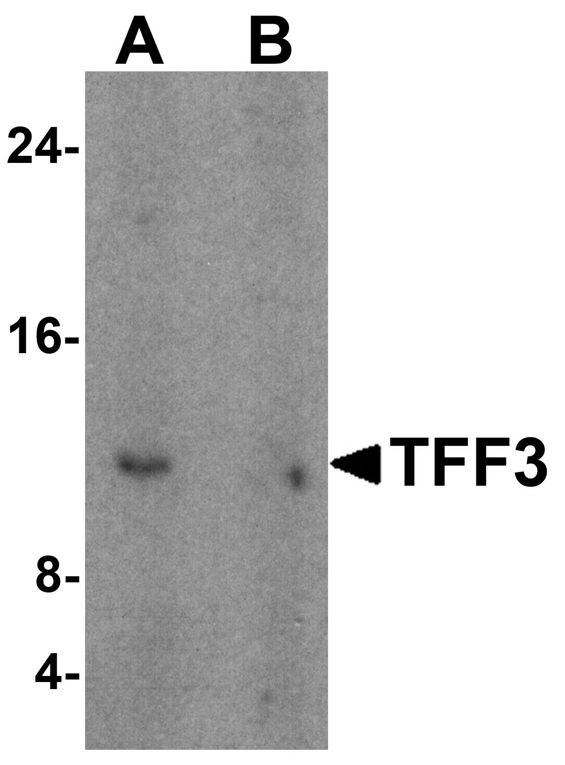 TFF3 Antibody - BSA Free
