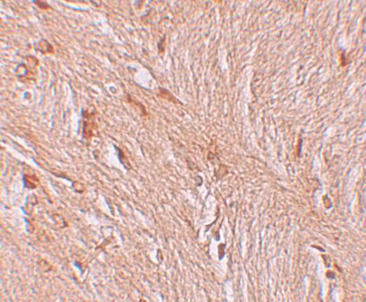 ZBTB3 Antibody - BSA Free